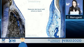 Analisi clinica, radiografica e molecolare del rapporto tra il margine di un restauro di seconda classe e i tessuti parodontali: studio di coorte pre-post