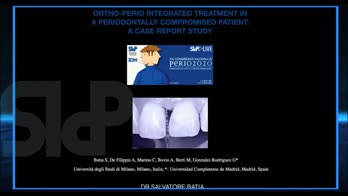 Trattamento integrato orto-perio in un paziente parodontalmente compromesso: case report