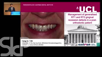 Management of generalised RT1 and RT2 recession defects in a post-orthodontic patient