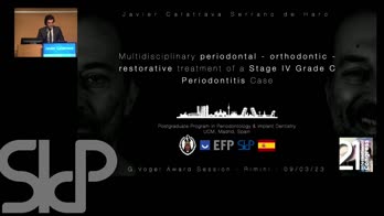 Multidisciplinary periodontal-orthodontic-restorative treatment of a Stage IV Grade C periodontitis case