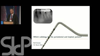 Quale radiologia nel paziente parodontale e implantare?