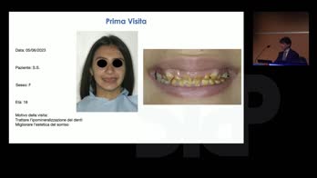 Treatment of amelogenesis imperfecta with periodontal and prosthetic approach in a young patient