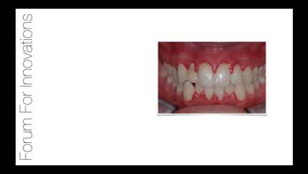 Qualità e sicurezza in chirurgia parodontale e implantare - qualità e sicurezza nel controllo del biofilm orale