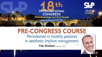Corso Pre-Congressuale: Gestione estetica nella terapia implantare del paziente sano e parodontale