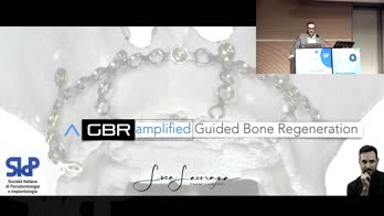 a-GBR: amplified Guided Bone Regeneration
