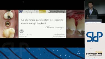 La chirurgia parodontale nel paziente candidato agli impianti:  obiettivi e strategie