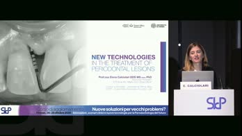 Le nuove tecnologie nel trattamento delle lesioni parodontali