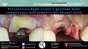 🇮🇹 Nell’aumento dei tessuti molli peri-implantari