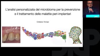 L’analisi personalizzata del microbioma per la prevenzione e il trattamento delle malattie peri-implantari